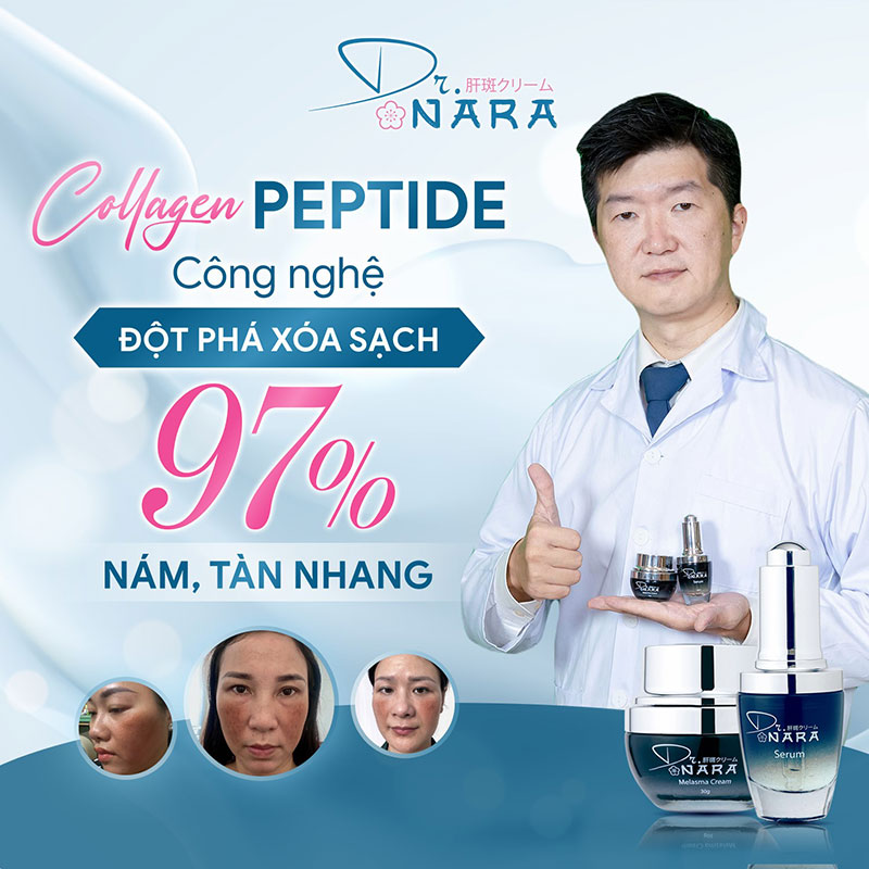 Hiệu Quả Tuyệt Vời Trong Trị Nám, Tàn Nhang Từ Công Nghệ Collagen ...